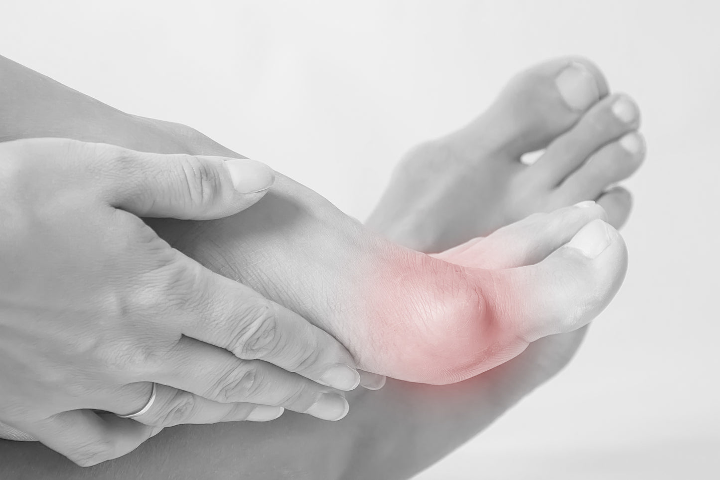 Hallux Balm: Intensive care and refreshment for painful bunions