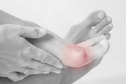 Baume Hallux : Soin intensif et rafraîchissement des oignons douloureux
